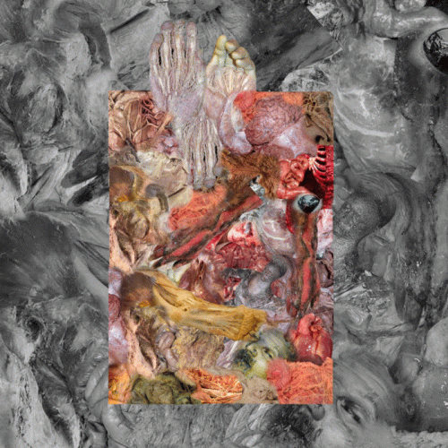 Lipoma : The Stench of Organs and Purulence Rapidly Decomposing